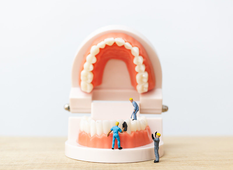 再植・移植治療