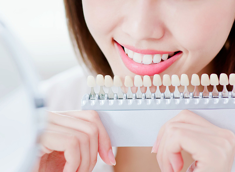 ホワイトニング