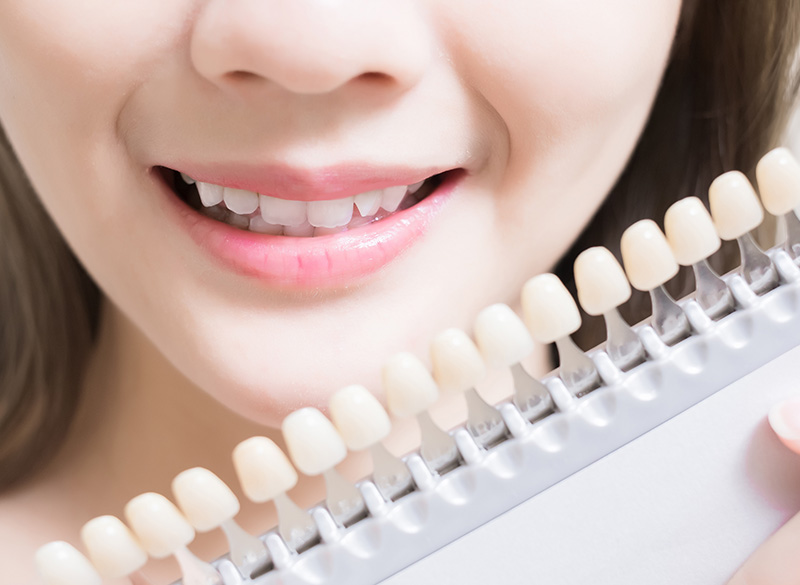 ホワイトニング